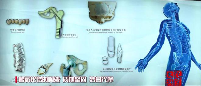 小小瓷片的“前世今生”(图7)